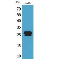CacyBP Polyclonal Antibody