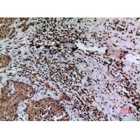 CacyBP Polyclonal Antibody