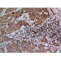 CacyBP Polyclonal Antibody