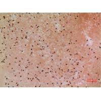 CacyBP Polyclonal Antibody