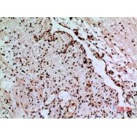 CacyBP Polyclonal Antibody