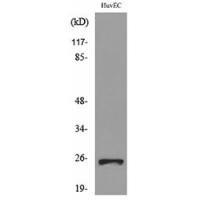 CacyBP Polyclonal Antibody
