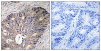 CAD Polyclonal Antibody
