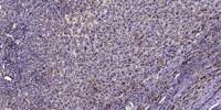 Cadherin-16 Polyclonal Antibody