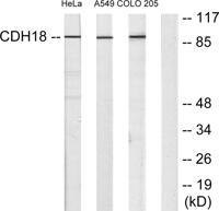 Cadherin-18 Polyclonal Antibody