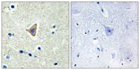 Cadherin-20 Polyclonal Antibody