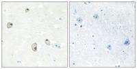 Cadherin-22 Polyclonal Antibody