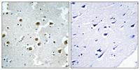 CAF-1 p60 Polyclonal Antibody