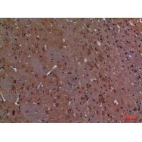Calbindin D28K Polyclonal Antibody