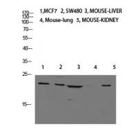 Calcitonin Polyclonal Antibody