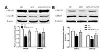 CALCR Polyclonal Antibody