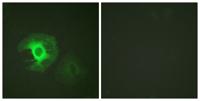 Caldesmon Polyclonal Antibody