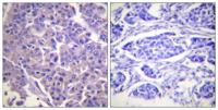 Caldesmon Polyclonal Antibody