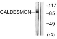Caldesmon Polyclonal Antibody
