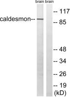 Caldesmon Polyclonal Antibody