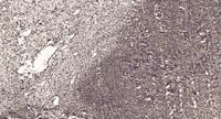 Calgizzarin Polyclonal Antibody
