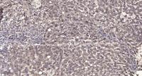 CALML5 Polyclonal Antibody