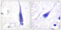Calmodulin Polyclonal Antibody