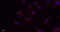 Calnexin Polyclonal Antibody