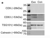 Calnexin Polyclonal Antibody