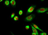 Calnexin Polyclonal Antibody