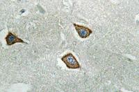 Calpain 2 Polyclonal Antibody