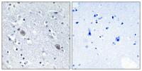 Calponin 2 Polyclonal Antibody