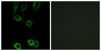 Calponin 2 Polyclonal Antibody