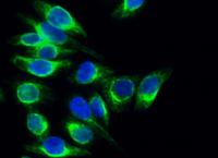 Calregulin Polyclonal Antibody
