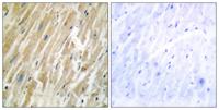 Calregulin Polyclonal Antibody