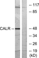 Calregulin Polyclonal Antibody