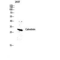 Calretinin Polyclonal Antibody