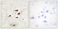 CaMKIIα/β/δ Polyclonal Antibody