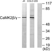 CaMKIIβ/γ Polyclonal Antibody