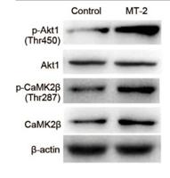 CaMKIIβ/γ/δ Polyclonal Antibody