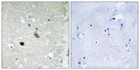 CaMKIIβ/γ/δ Polyclonal Antibody