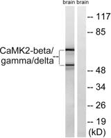 CaMKIIβ/γ/δ Polyclonal Antibody