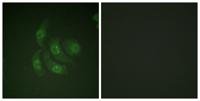 CaMKIV Polyclonal Antibody
