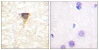 CaMKIV Polyclonal Antibody