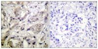 CaMKIα Polyclonal Antibody