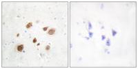 CaMKIβ Polyclonal Antibody