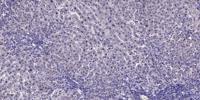 CaMKK2 Polyclonal Antibody