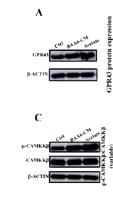 CaMKK2 Polyclonal Antibody