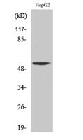 CaMKV Polyclonal Antibody