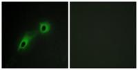 CaMKV Polyclonal Antibody