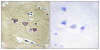 CaMKV Polyclonal Antibody