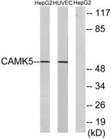 CaMKV Polyclonal Antibody