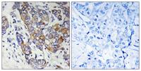 Carbonyl Reductase 1 Polyclonal Antibody