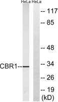 Carbonyl Reductase 1 Polyclonal Antibody