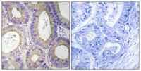 Carbonyl Reductase 3 Polyclonal Antibody